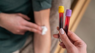 A stock photograph of a nurse holding two tubes of blood. In the background, a patient in a green shirt holds a cotton ball to their arm after having blood drawn.